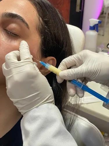 تزریق ژل در کلینیک پیشرفته و تخصصی زیبایی آلما در رشت