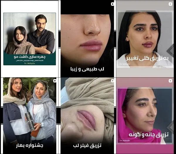 دکتر جوانسازی پوست در شیراز، دکتر متقی