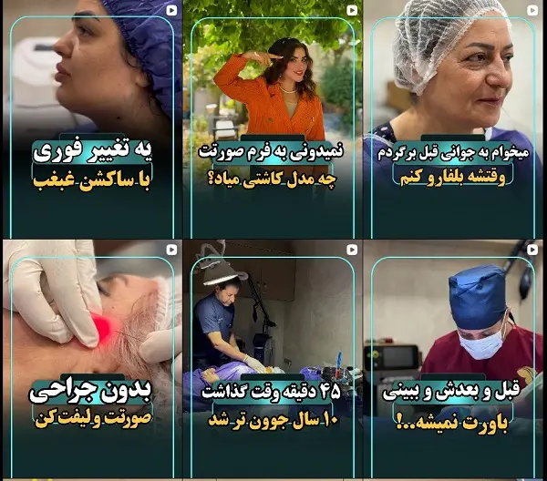 زیبایی دکتر کریم زاده، جوانسازی پوست صورت و بدن در شیراز