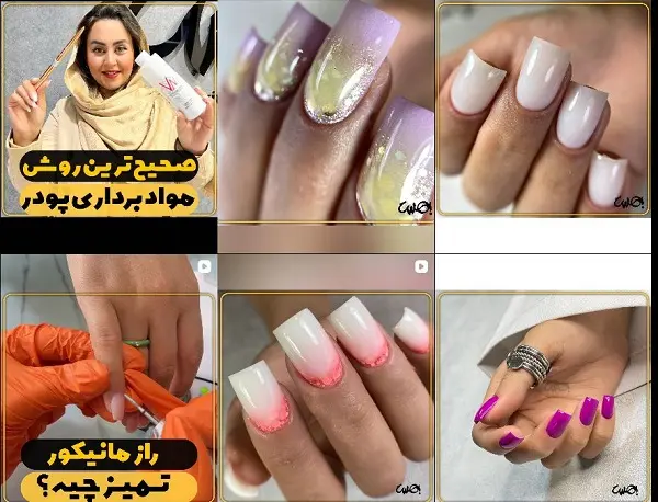 مرکز کاشت ناخن بهسا در کرمان