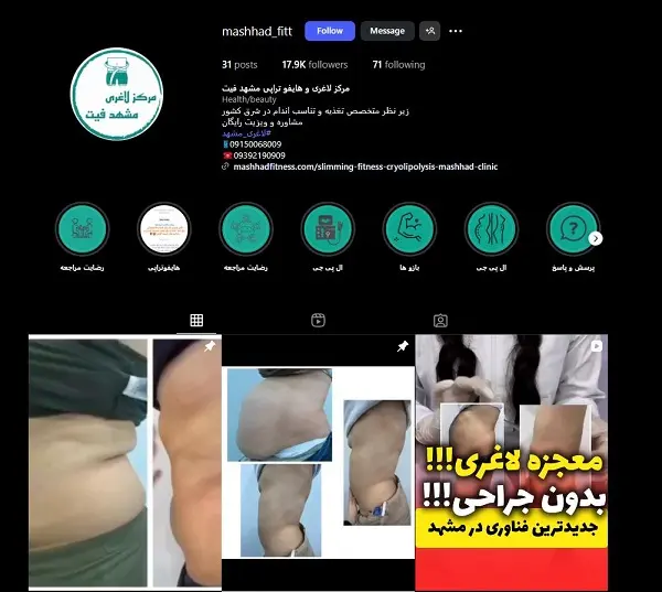 مرکز لاغری مشهد فیت