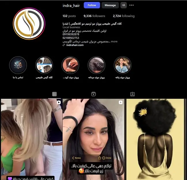 مرکز کاشت مو ایندرا تهران