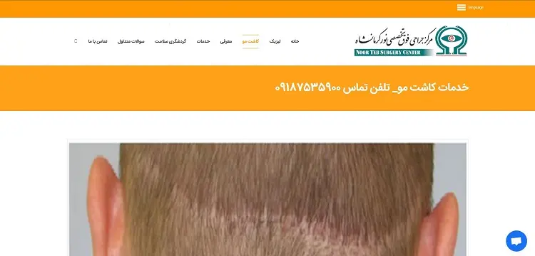 مرکز جراحی و کاشت مو تخصصی نور
