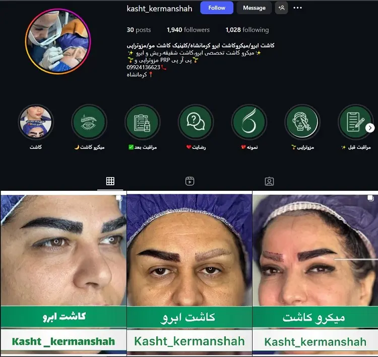 مرکز کاشت مو کرمانشاه کرمانشاه