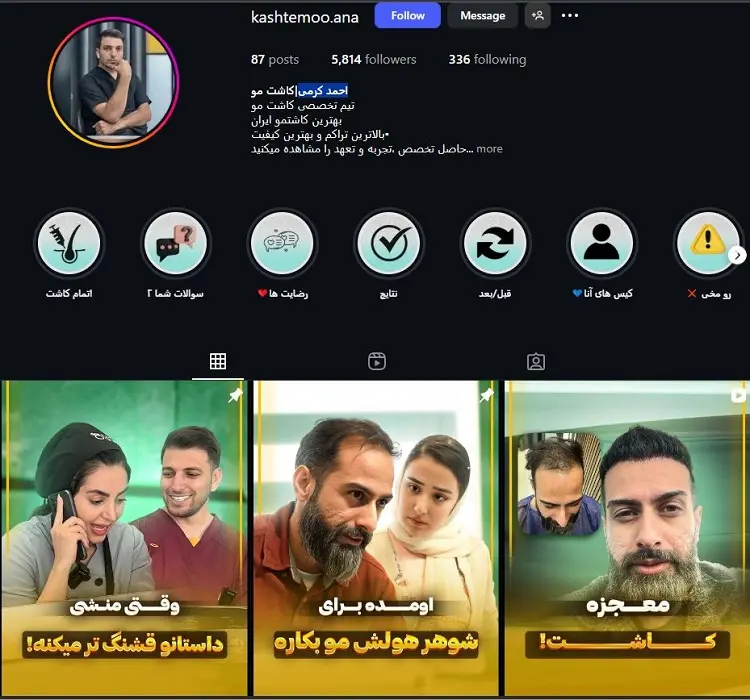 کاشت مو دکتر احمد کرمی