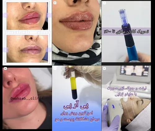 کلینیک تخصصی پیشرفته زیبایی مهتاب در رشت