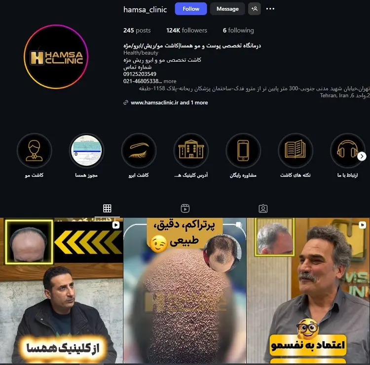 کلینیک تخصصی کاشت مو همسا تهران