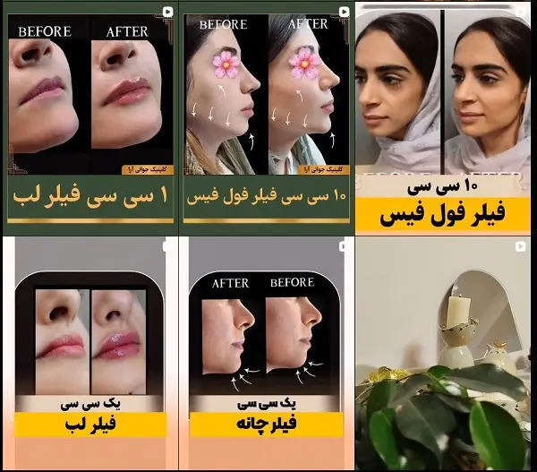 کلینیک لیزر زیبایی آرا در بندرعباس