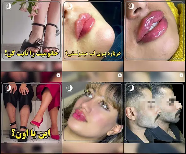 کلینیک زیبایی آیسان در بندرعباس