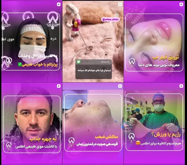 کلینیک زیبایی اطلس تبریز