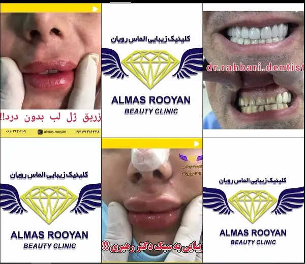 کلینیک زیبایی الماس رویان در اهواز