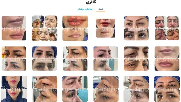 کلینیک زیبایی اکسیر در بندرعباس