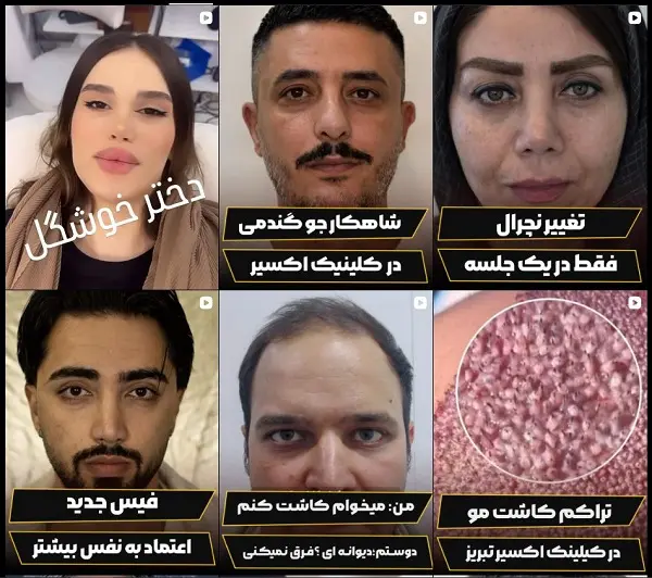 کلینیک زیبایی اکسیر تبریز