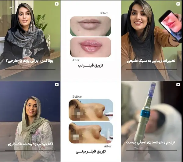 کلینیک زیبایی بهار یزد