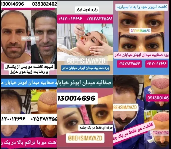 کلینیک زیبایی بهسیما در یزد