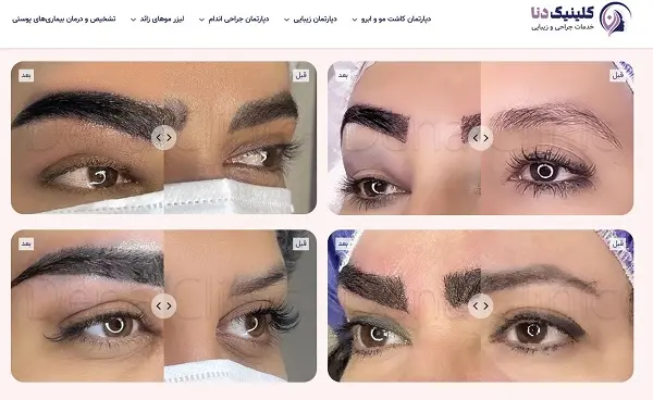 کلینیک زیبایی دنا در شیراز