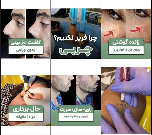 کلینیک زیبایی دکتر مسعود باوی اهواز