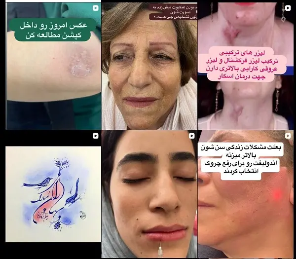 کلینیک زیبایی دکتر نرگس قانعی یزد