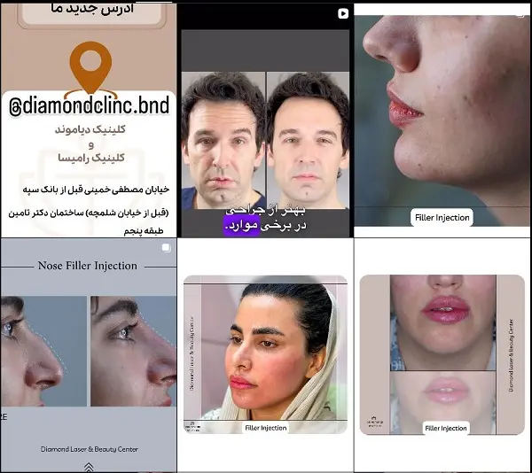 کلینیک زیبایی رامیسا در بندرعباس