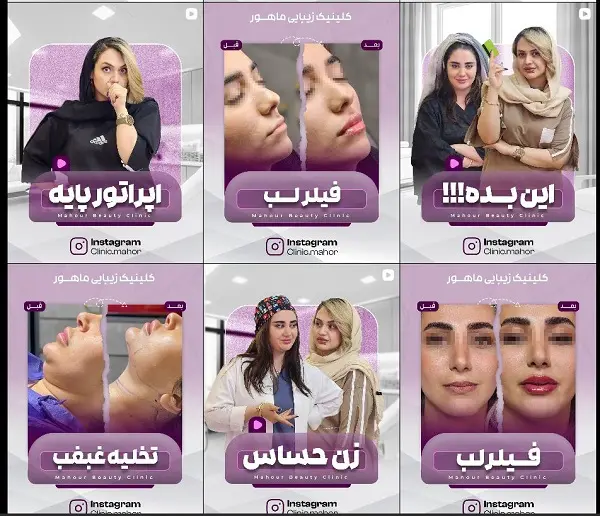 کلینیک زیبایی ماهور در تبریز