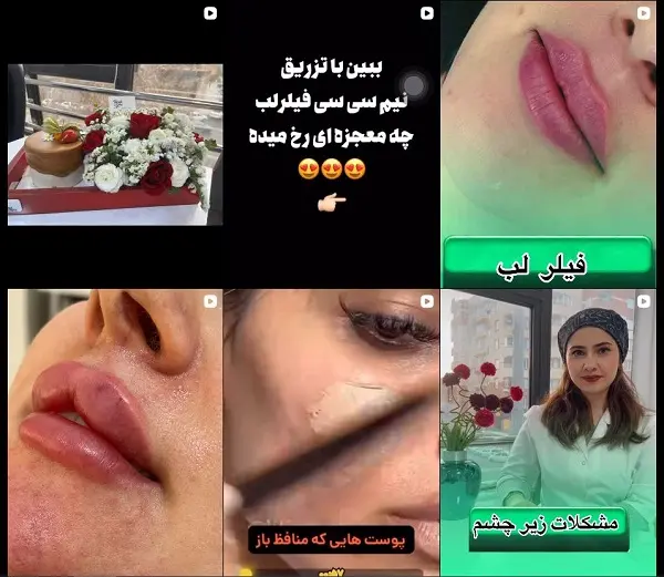 کلینیک زیبایی میرا تبریز