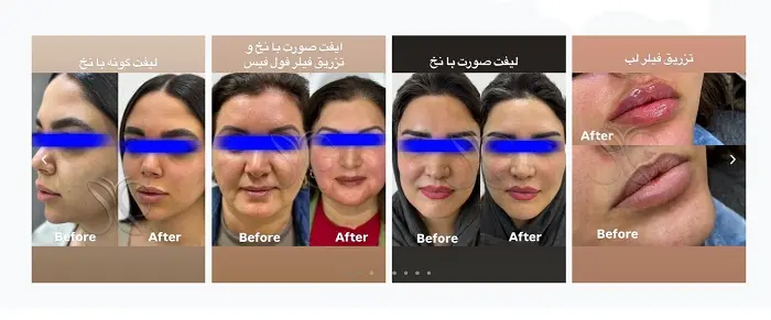 کلینیک نونا قبادی در شیراز