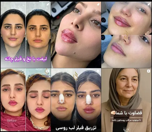 کلینیک زیبایی هیرا در شیراز