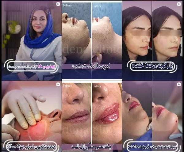 مرکز جوانسازی پوست دنا در شیراز