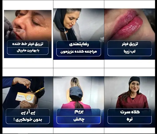 کلینیک زیبایی و جوانسازی پوست در شیراز، دکتر نقیب