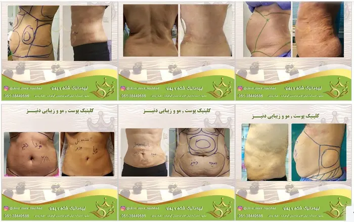 کلینیک لاغری دنیز مشهد