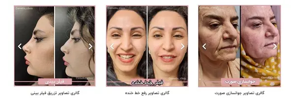 کلینیک زیبایی کاملیا در کرج