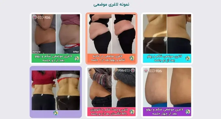 کلینیک لاغری ماهان مشهد