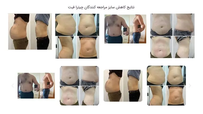 کلینیک لاغری چیترا قیت در اهواز