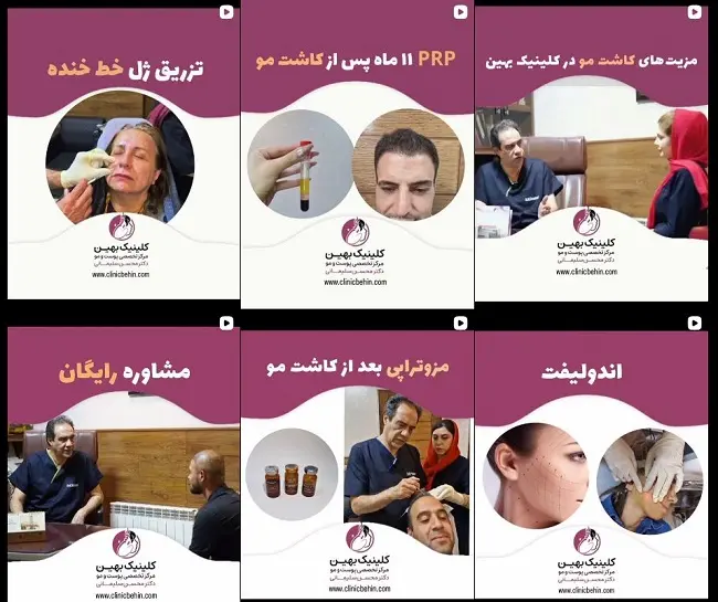کلینیک کاشت مو بهین ( دکتر سلیمانی )