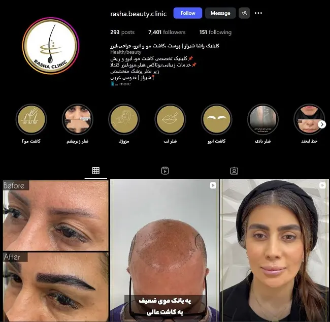 مرکز کاشت مو در شیراز، راشا