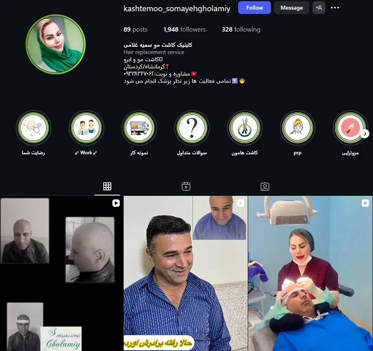 کلینیک کاشت مو سمیه غلامی کرمانشاه