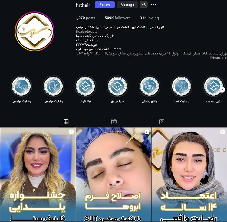 کلینیک کاشت مو سينا در تهران