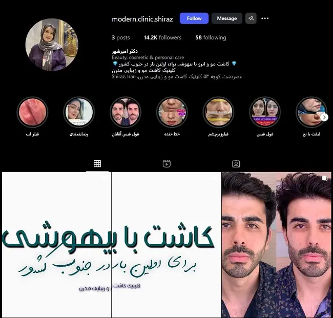 کلینیک کاشت موی مدرن شیراز