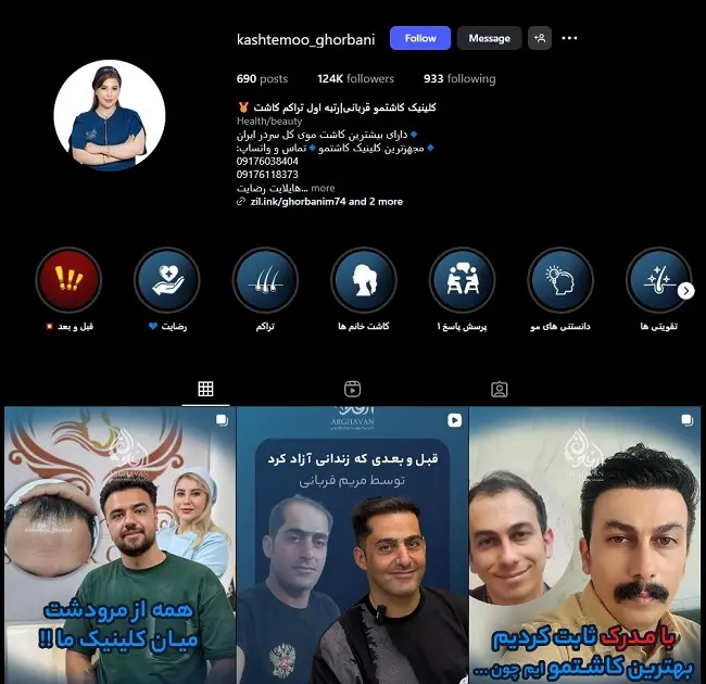 کلینیک کاشت مو مریم قربانی