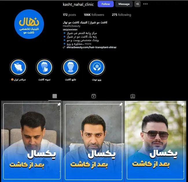 کلینیک کاشت مو نهال شیراز