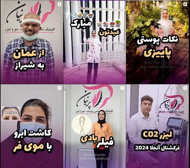 مرکز کاشت مو در شیراز؛ کلینیک پرنیان