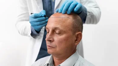 بهترین کلینیک و مراکز کاشت مو در شیراز
