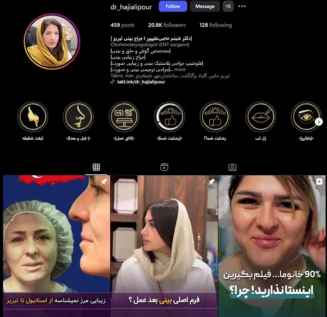 جراح خانم عمل زیبایی بینی، شبنم حاجی علیپور