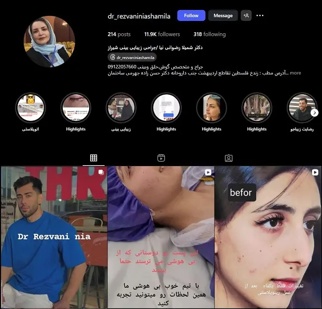 دکتر خانم عمل بینی در شیراز، شمیلا رضوانی نیا