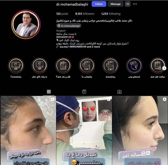 دکتر عمل بینی محمد بالاغی