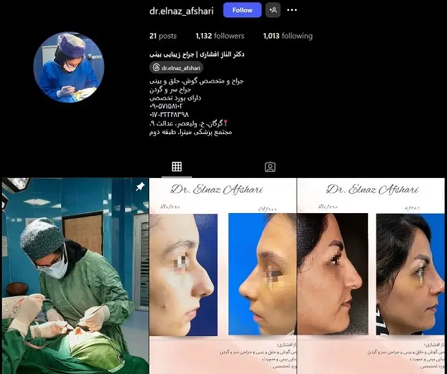 دکتر الناز افشاری، جراح خانم عمل بینی در گرگان