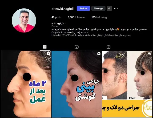 دکتر نوید نقدی جراح عمل بینی در همدان