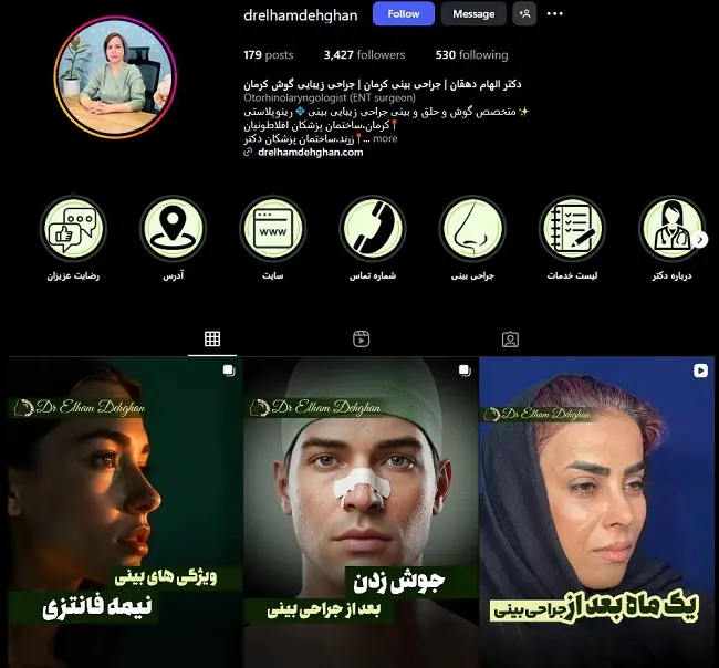 دکتر الهام دهقان، جراحی بینی در کرمان