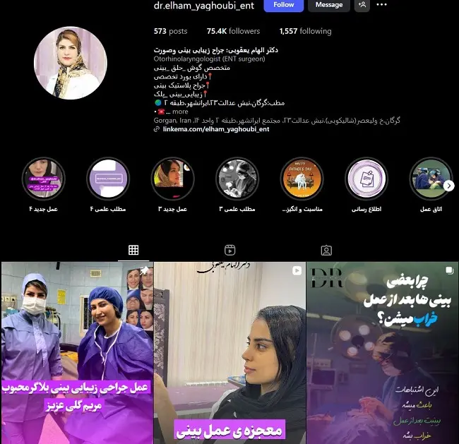 دکتر الهام یعقوبی، جراح خانم عمل بینی در گرگان
