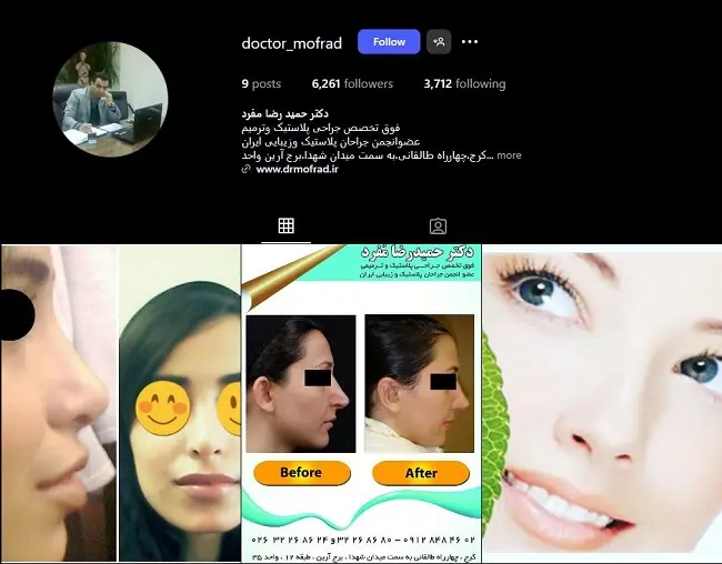 دکتر حمیدرضا مفرد، جراح عمل بینی در کرج